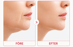 Brightskin V-Lift™ – kylande ansiktsband för en mer definierad käklinje, 4-pack