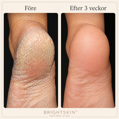 BrightSkin™ SoftHeel Stick
