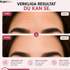 Brightskin Sverige™ PureLift Balm